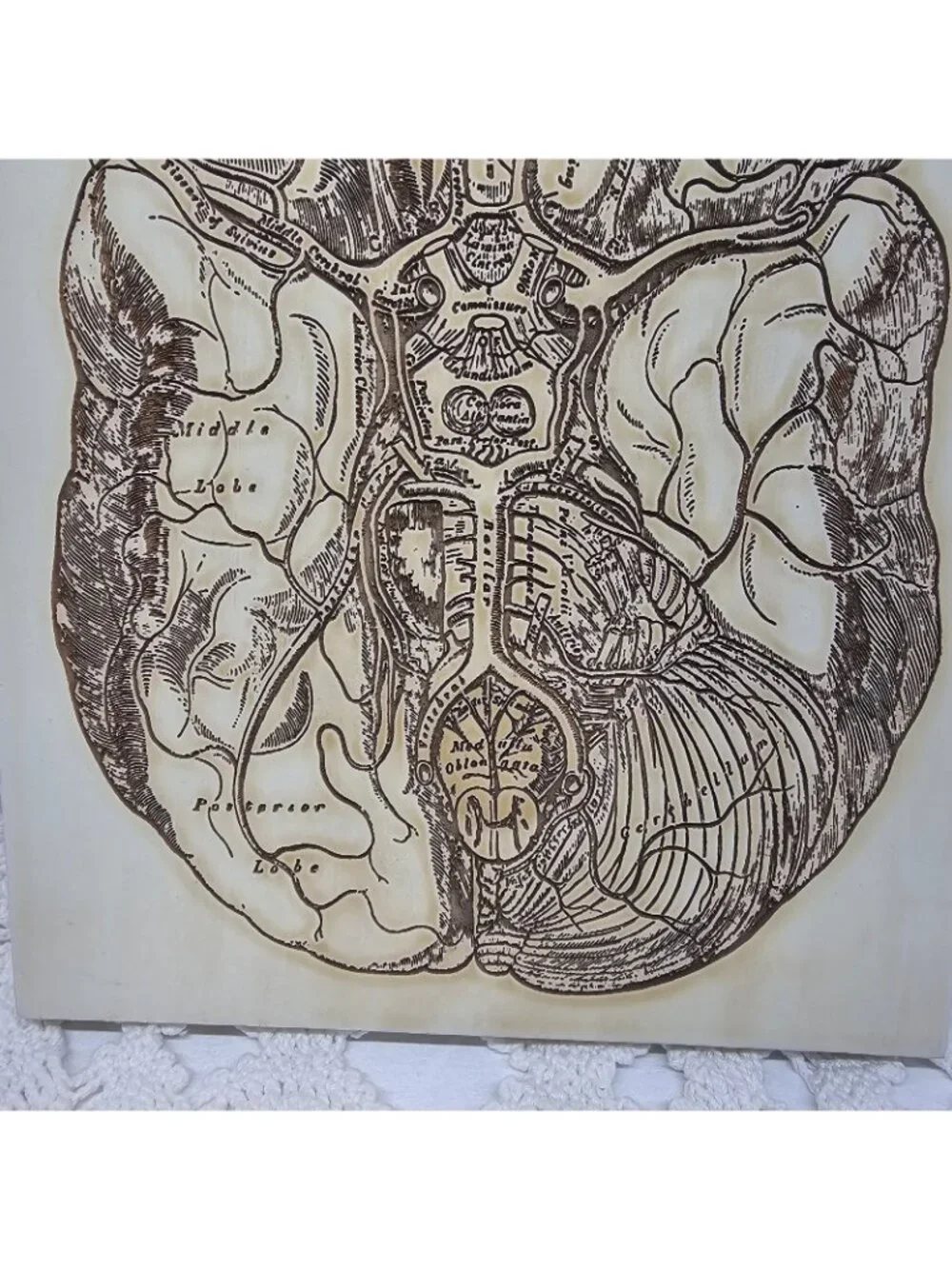 Vintage Gray’s Anatomy Brain Arteries Wood Wall Plaque Medical Art Doctor Gift